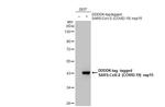 SARS-CoV-2 NSP15 Antibody in Western Blot (WB)