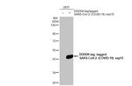 SARS-CoV-2 NSP15 Antibody in Western Blot (WB)