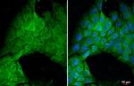 PP2A alpha Antibody in Immunocytochemistry (ICC/IF)