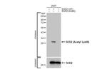 Acetyl-SOD2 (Lys68) Antibody in Western Blot (WB)