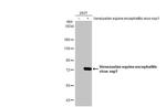 Venezuelan Equine Encephalitis Virus NSP1 Antibody in Western Blot (WB)