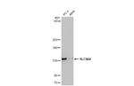 SLC4A4 Antibody in Western Blot (WB)