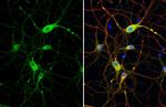 DRD2 Antibody in Immunocytochemistry (ICC/IF)