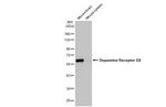 DRD2 Antibody in Western Blot (WB)