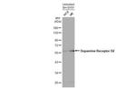 DRD2 Antibody in Western Blot (WB)