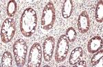 MUC4 Antibody in Immunohistochemistry (Paraffin) (IHC (P))