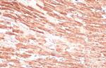 Cardiac Troponin I Antibody in Immunohistochemistry (Paraffin) (IHC (P))