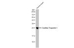 Cardiac Troponin I Antibody in Western Blot (WB)