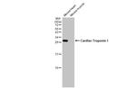 Cardiac Troponin I Antibody in Western Blot (WB)