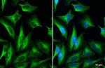 TOMM20 Antibody in Immunocytochemistry (ICC/IF)