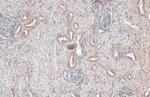 RAB5 Antibody in Immunohistochemistry (Paraffin) (IHC (P))