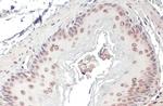 POLB Antibody in Immunohistochemistry (Paraffin) (IHC (P))