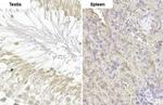 POLB Antibody in Immunohistochemistry (Paraffin) (IHC (P))