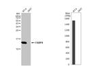 FABP4 Antibody in Western Blot (WB)