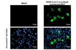 SARS-CoV-2 NSP8 Antibody in Immunocytochemistry (ICC/IF)