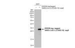 SARS-CoV-2 NSP8 Antibody in Western Blot (WB)