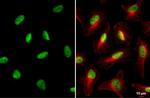 TRIM28 Antibody in Immunocytochemistry (ICC/IF)