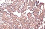 MCL-1 Antibody in Immunohistochemistry (Paraffin) (IHC (P))