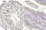 MCL-1 Antibody in Immunohistochemistry (Paraffin) (IHC (P))