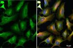 eIF4E Antibody in Immunocytochemistry (ICC/IF)