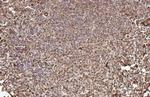 ADAM17 Antibody in Immunohistochemistry (Paraffin) (IHC (P))