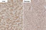 ADAM17 Antibody in Immunohistochemistry (Paraffin) (IHC (P))