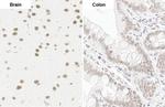 U2AF2 Antibody in Immunohistochemistry (Paraffin) (IHC (P))