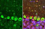 DRD2 Antibody in Immunohistochemistry (Paraffin) (IHC (P))