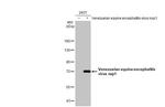 Venezuelan Equine Encephalitis Virus NSP1 Antibody in Western Blot (WB)
