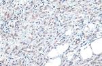 B-Raf Antibody in Immunohistochemistry (Paraffin) (IHC (P))