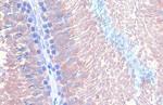 B-Raf Antibody in Immunohistochemistry (Paraffin) (IHC (P))