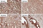 B-Raf Antibody in Immunohistochemistry (Paraffin) (IHC (P))