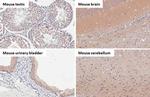 B-Raf Antibody in Immunohistochemistry (Paraffin) (IHC (P))