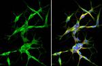 Synaptotagmin 1 Antibody in Immunocytochemistry (ICC/IF)