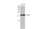 SOD1 Antibody in Western Blot (WB)