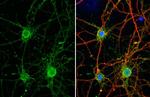 Synaptotagmin 1 Antibody in Immunocytochemistry (ICC/IF)