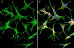 Synaptotagmin 1 Antibody in Immunocytochemistry (ICC/IF)