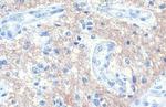 SNAP91 Antibody in Immunohistochemistry (Paraffin) (IHC (P))