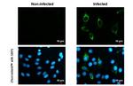 Zika Virus NS4B Antibody in Immunocytochemistry (ICC/IF)