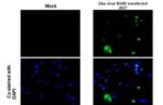 Zika Virus NS4B Antibody in Immunocytochemistry (ICC/IF)