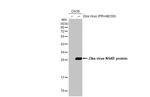 Zika Virus NS4B Antibody in Western Blot (WB)