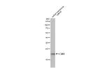 CD81 Antibody in Western Blot (WB)