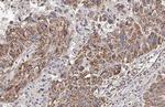 HCK Antibody in Immunohistochemistry (Paraffin) (IHC (P))