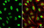 GTF2I Antibody in Immunocytochemistry (ICC/IF)