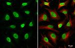 HDAC1 Antibody in Immunocytochemistry (ICC/IF)