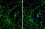 Beta III Tubulin Antibody in Immunocytochemistry (ICC/IF)