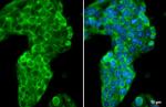 ApoA1 Antibody in Immunocytochemistry (ICC/IF)