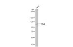 HGS Antibody in Western Blot (WB)