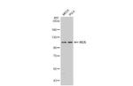 HGS Antibody in Western Blot (WB)