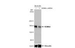 KDM6A Antibody in Western Blot (WB)